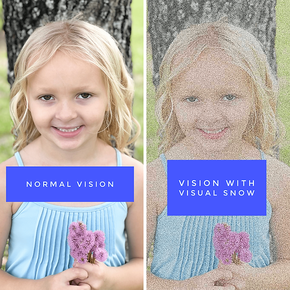 young blonde girl with flowers, normal vision on left image, visual snow syndrome vision on right image