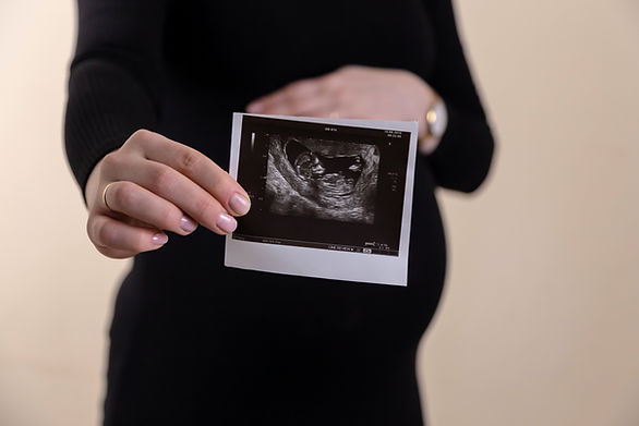 woman holding her belly and ultrasound photo