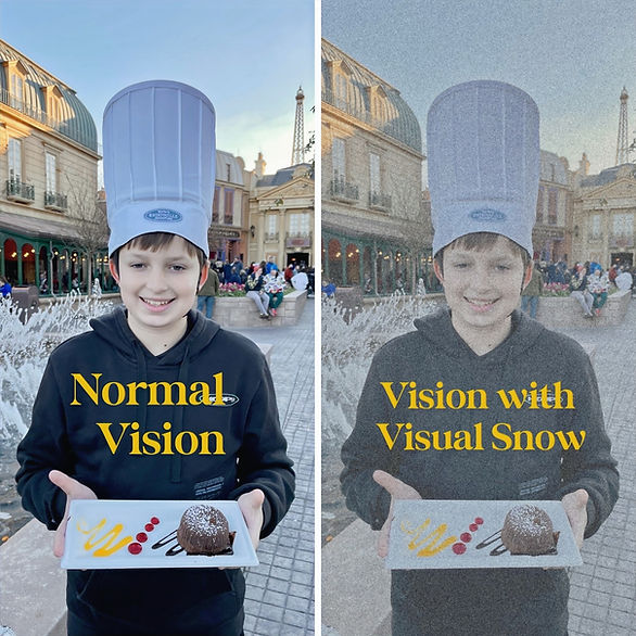 boy with chef hat holding food with clear vision on left and visual snow vision on right