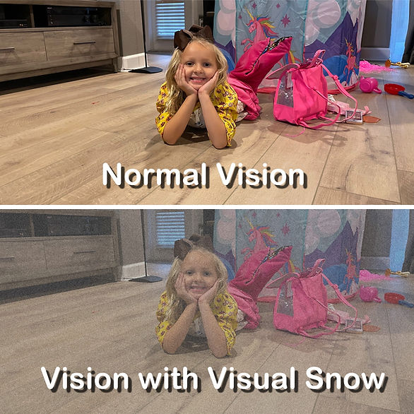 young girl in mermaid tail lying on the floor with normal vision on top image and visual snow vision on bottom image